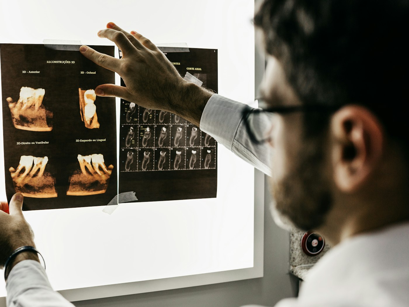 Low-dose digital radiology